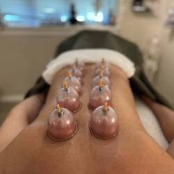 Cupping på ryg i Nordsjælland