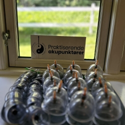 Cupping i Espergærde i Nordsjælland