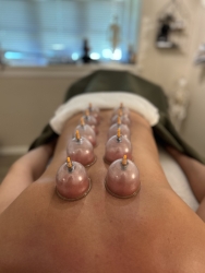 Cupping på ryg i Nordsjælland